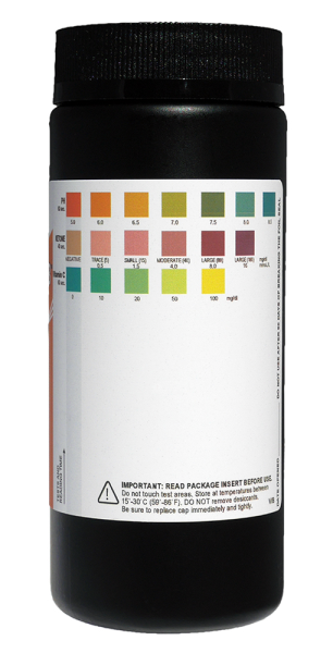URINE CHECK